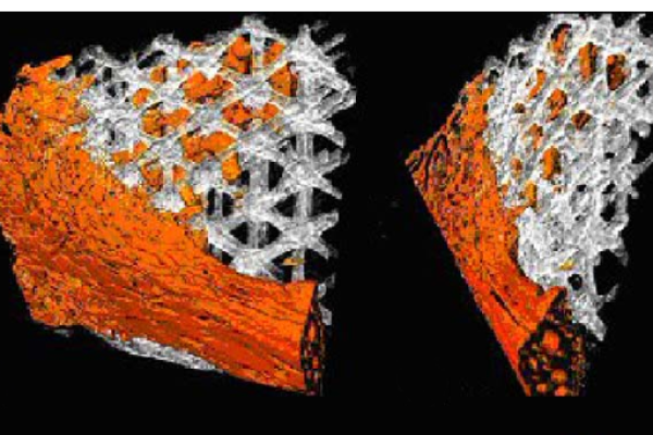 Analysis of 3D Bone Ingrowth into Polymer Scaffolds via Micro Computed Tomography Imaging